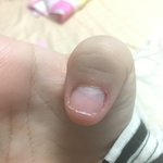 [댓글부탁해] <b>손톱</b> 기르는 데 <b>손톱</b>이 왜이렇게 길러지지??