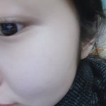 [댓글부탁해] 피부 짱<b>조치</b>!!!!
