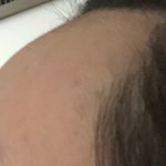 [ㅋㅋㅋㅋㅋ] 나보다 <b>이마</b> 넓은 사람 없을듯 ㅋㅋ