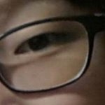 [ㅋㅋㅋㅋㅋ] 쌍수 <b>전후</b> 차이 ㅋㅋㅋㅋㅋㅋㅋㅋㅋㅋㅋㅋㅋ