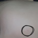 [댓글부탁해] 내 <b>백옥</b>같은 피부에 머가 남
