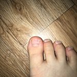 얘들아 나 <b>발톱</b> 뗐다