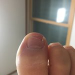 [혐주의] 나 <b>발톱</b>없음
