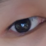 [댓글부탁해] 이거 다래끼야??