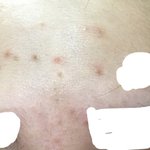 [조언부탁해] <b>미세</b>먼지때문에 피부;;