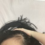 이거 <b>선천</b>적으로 머리 없는 건 어캄??