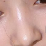 저 <b>코에</b> 구멍같은거
