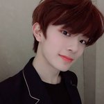 뾰루지 나서 고민인 아이돌
