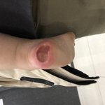25개월아이가 대학병원에서 의료사고를 당했습니다.