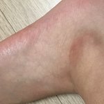 얘들아 <b>복숭아뼈</b>에 이런거 있으면 더러워보임?