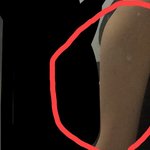 [19] <b>팔뚝살</b> 어떻게 빼?ㅠ