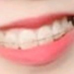 나 <b>교정</b>중인데 선택좀 내 인생이 달림