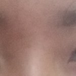<b>내</b> <b>눈</b> 앞트임 해야 돼?