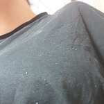 <b>비듬</b> 혐)친구랑 머리안감기 내기중임