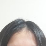 나 <b>뿌리</b> 많이 죽어있어?