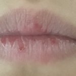 [드루와] 나낼 교정<b>때</b><b>매</b> 치과가는데 <b>입술</b>개뜯어서