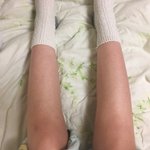[댓글부탁해] 다리 나같은 애들 있음?(사진ㅇ