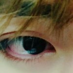 뷔 <b>눈</b> <b>언더</b>에