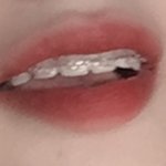 [기분좋아라] 나 교정중인데 확실히 예전이랑 다르게