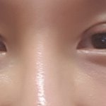 <b>쌍수</b>망한거죠