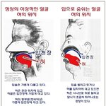 야ㅠㅜㅜㅜ 급해 눈 갑자기 개나빠졌는데