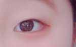 [드루와] 얘들아 나 쌍수 <b>전후</b>