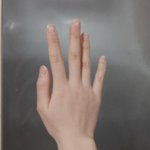 나 <b>손목뼈</b> 겁나 심하게 튀어나옴