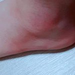 [댓글부탁해] 나 <b>발목</b> 삐엇는데