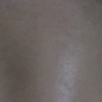 쌍수 <b>두달</b>반인데 붓기 더 빠지겠지??ㅜㅜ