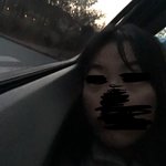 [댓글부탁해] 하 ... 다크<b>서클</b> 나보다 심한사람있음?