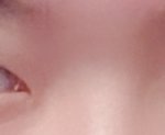 [드루와] 나 쌍수하면 잘될것 같아?