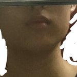 [댓글부탁해] 나같이 <b>사각</b>턱 심한 사람 있어?