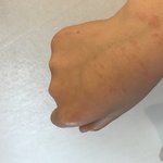 고양이가 내 <b>팔</b> 이렇게 만들어놈 ㅠㅠ