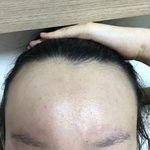 [사진필수] <b>이마</b> 크기 대회하자!!
