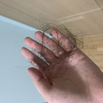 [댓글부탁해] <b>이</b>정도면 탈<b>모임</b>?(약혐주의)