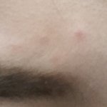 [댓글부탁해] 이니스프리 <b>납작</b>브로우 쓰고 눈썹 위에 뾰루지 남;