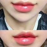 요즘 <b>유행</b>한다는 성형수술ㄷㄷ