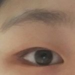 <b>속</b><b>쌍</b>인데 쌍수할까말까