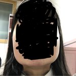 나 <b>양악</b>할까?