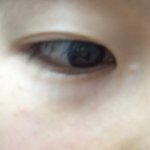<b>눈</b> <b>옆</b>에 이런 거 낫는데 뭘까 ...