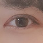 [댓글부탁해] 쌍수한지 <b>한</b>달 <b>반</b> 됐는데 어때?