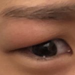 <b>눈</b>에 모기물렸을<b>때</b> 사진 볼래?ㅋㅋㅋㅋㅋㅋㅋㅋㅋ