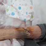 [도와주세요] [도와주세요] 경북 <b>보림</b>원(요양원)에 계시던 증조할머니께서...