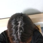 나 <b>정수리</b> 탈모임?