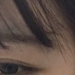 <b>눈밑</b>에 기미야 주근깨야 ㅠㅠ