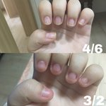 [댓글부탁해] 나 <b>손톱</b> 존내 예뻐짐