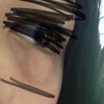 나 <b>눈밑</b>에 난거 뭐임 ㅠㅠㅠㅠ (약혐)