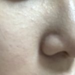 [드루와] 혐) 이런 피부는ㅠㅠ