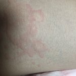 약혐일수도)이거 생리대 안맞아서<b>이러</b>늨거임..?