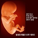 낙태<b>허용</b>..?